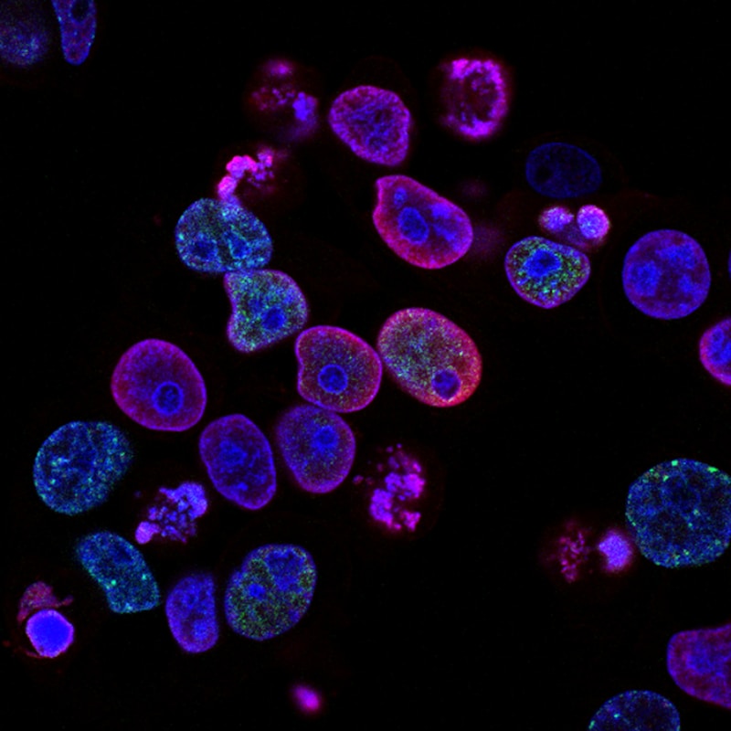 Microscopic Study Reveals Sophisticated Cellular Communication Networks in Human Brain